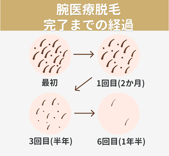 脱毛する時期はいつがいい 始める年齢やvio 腕脚の効果が出る時期も解説 知識 脱毛 おすすめの脱毛クリニック 脱毛サロン紹介メディア