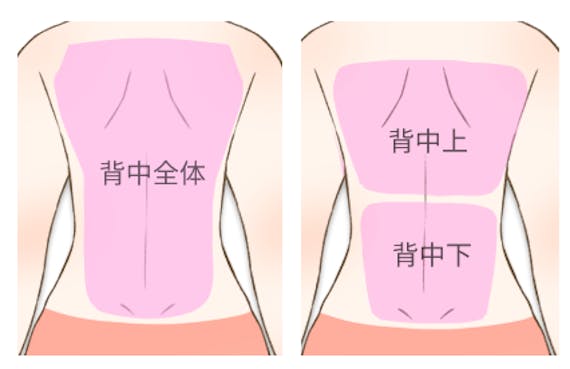 背中脱毛の回数って おすすめのサロン 医療クリニック6選 ニキビや産毛対策にも 部位 脱毛 おすすめの脱毛クリニック 脱毛 サロン紹介メディア