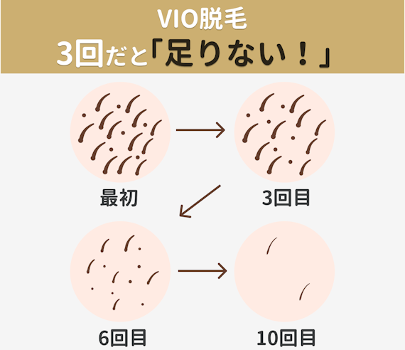 Vio脱毛の形を人気順に紹介 男ウケがいいのはどれ 自己処理の仕方も解説 部位 脱毛 おすすめの脱毛クリニック 脱毛サロン紹介メディア Vio脱毛の形を人気順に紹介 男ウケがいいのはどれ 自己処理の仕方も解説 部位 脱毛 おすすめの脱毛クリニック 脱毛サロン紹介メディア